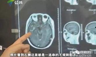 吃瓜黑料医学解密,吃瓜黑料背后的医学真相