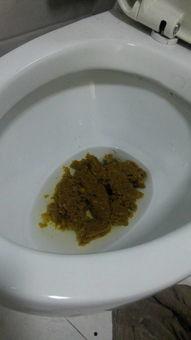 吃方瓜孑大便是黑的吗